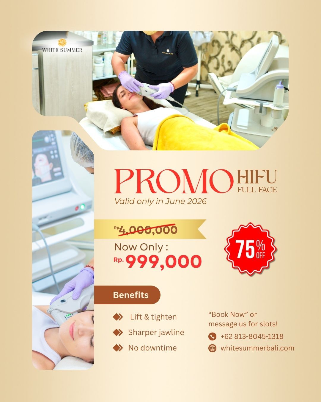 promo hifu in bali